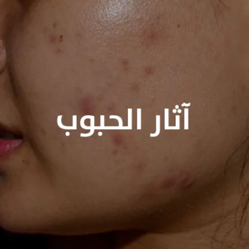آثار الحبوب
