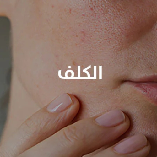 التصبغات