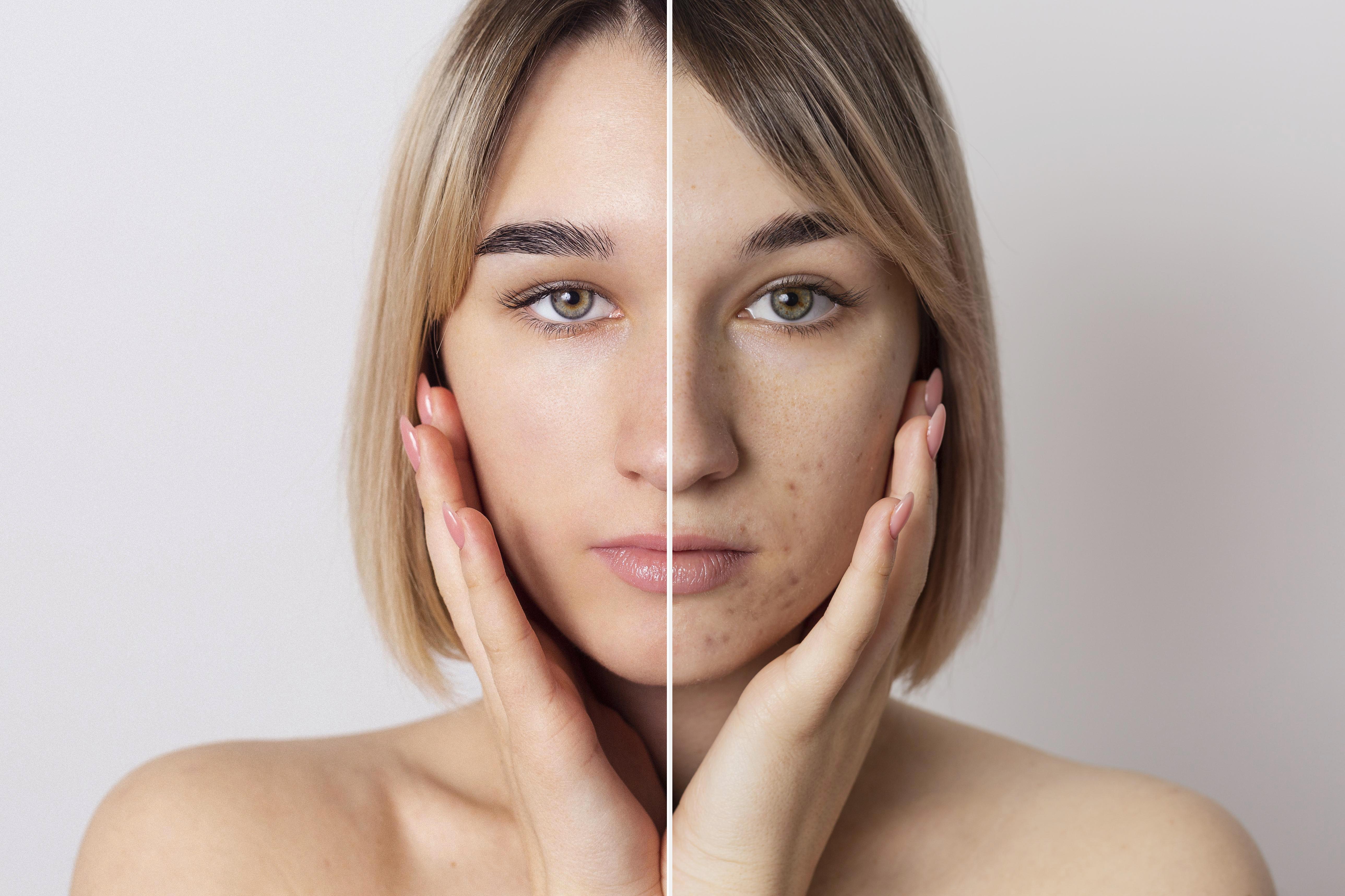 Before and After Clinical Skin Retouch